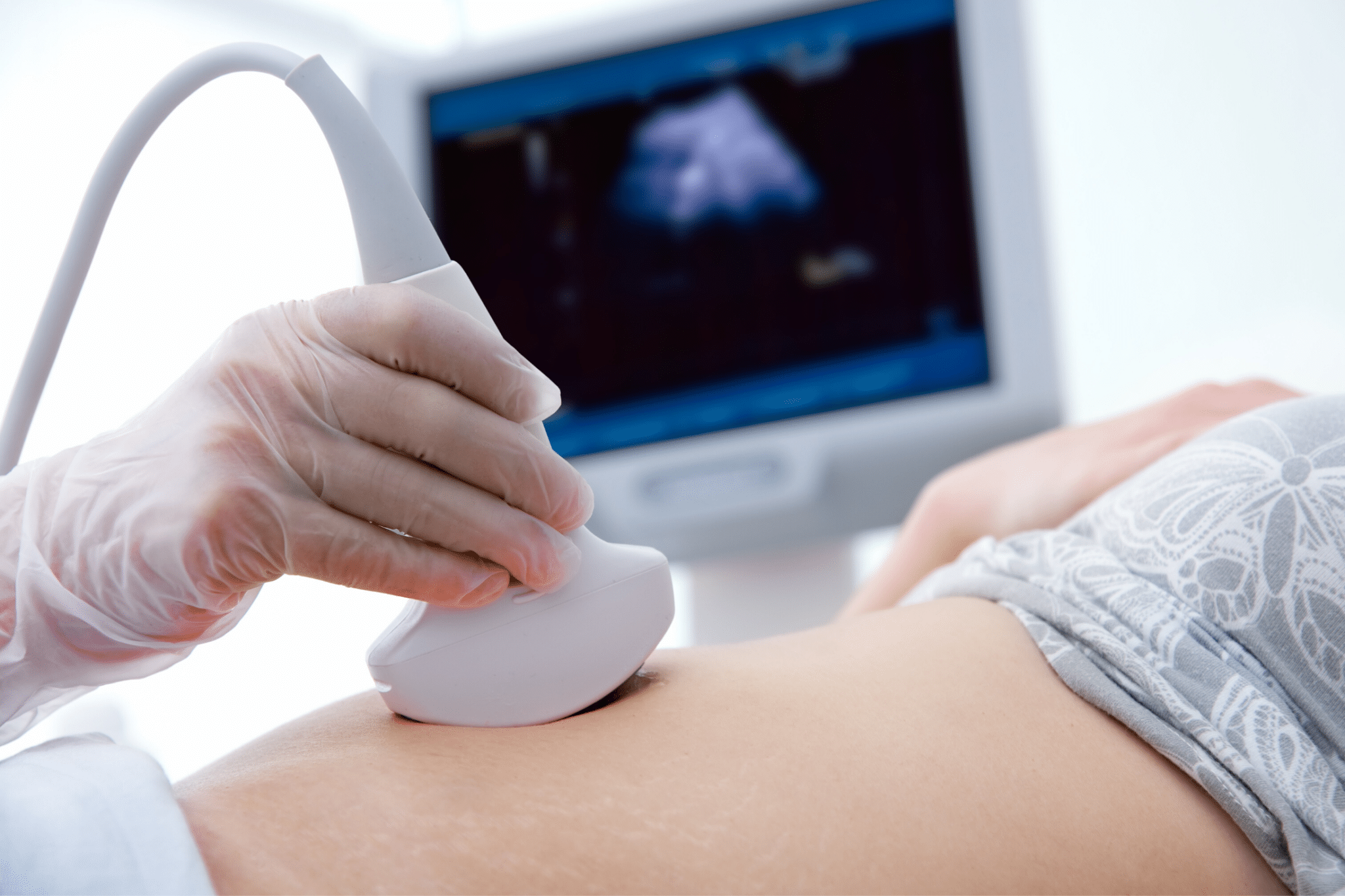 Ultrasounds: How Many Should I Have?