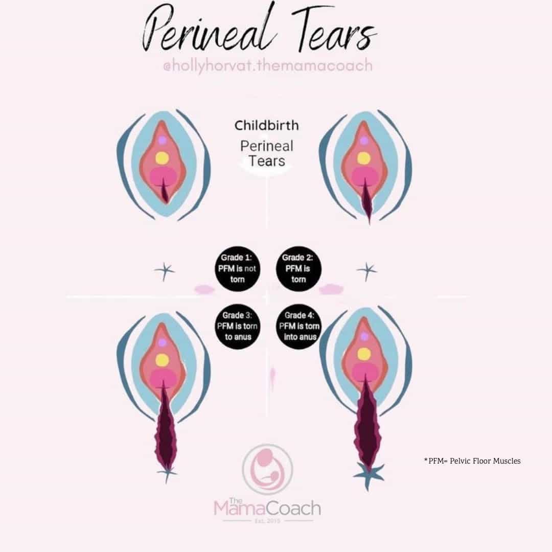 Vaginal Tears After Sex